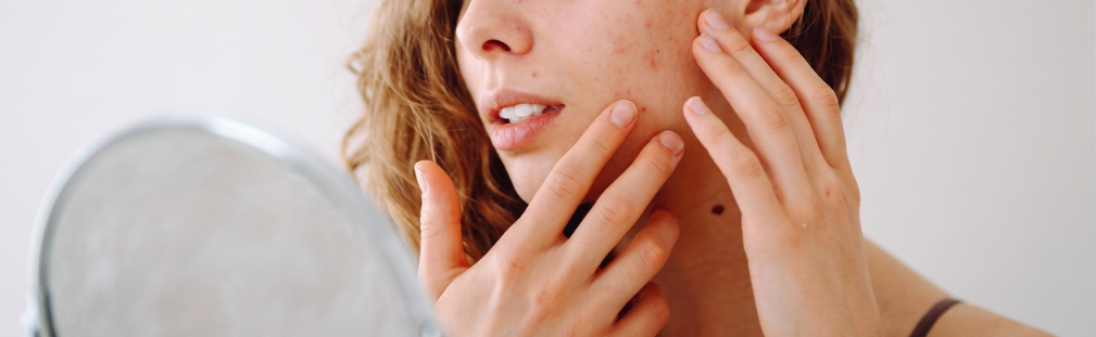 Your Cycle Affects Your Skin, Here’s How to Support It with Food-Based Nutraceuticals